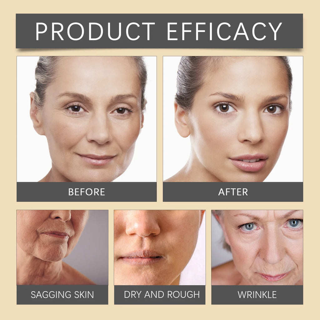 Bee Venom Wrinkle Removal Cream Firming Lifting Facial Moisturizing Deep Hydration Smoothing Fine Lines Anti Aging Face Cream