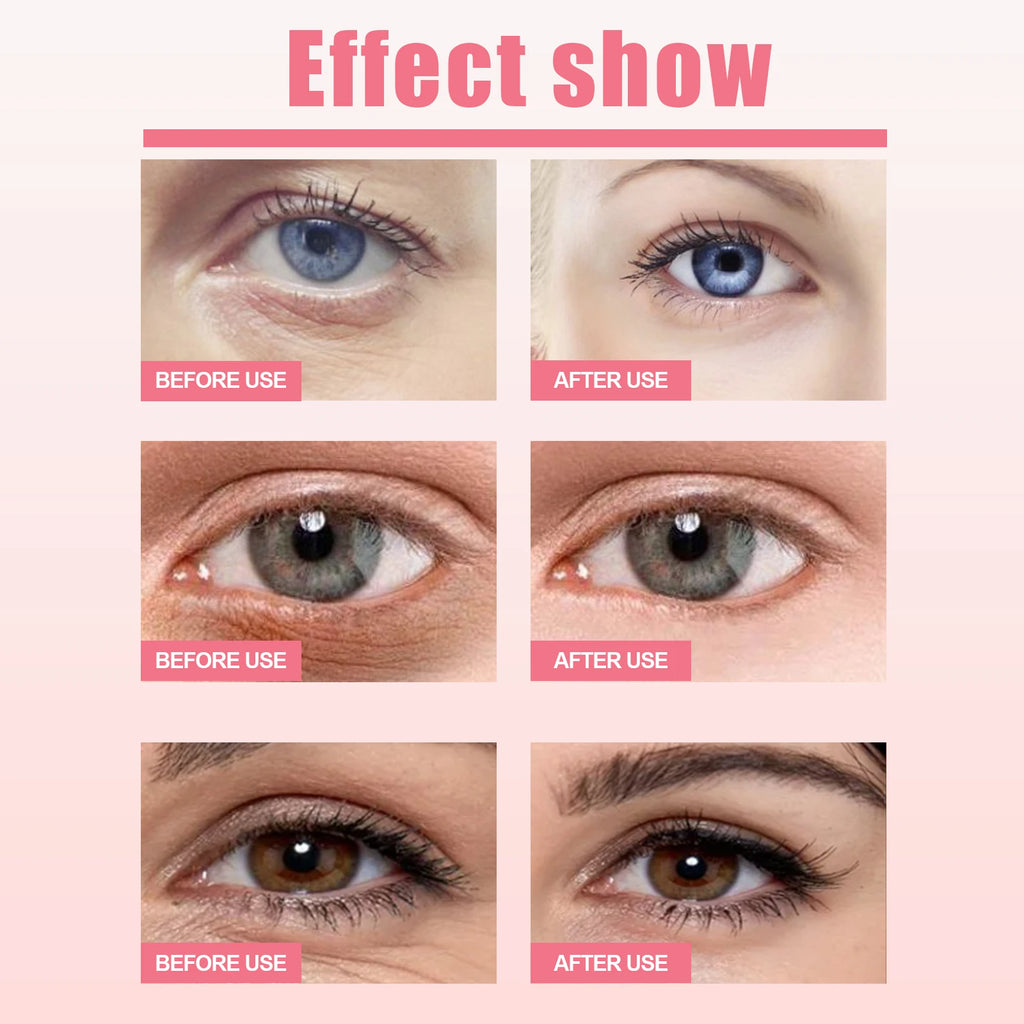 Women Extra Renewing Rosehip Eye Balm Face Lifting Moisturizing Balm Stick Fine Lines Removal Hyaluronic around the Eye Care15ml