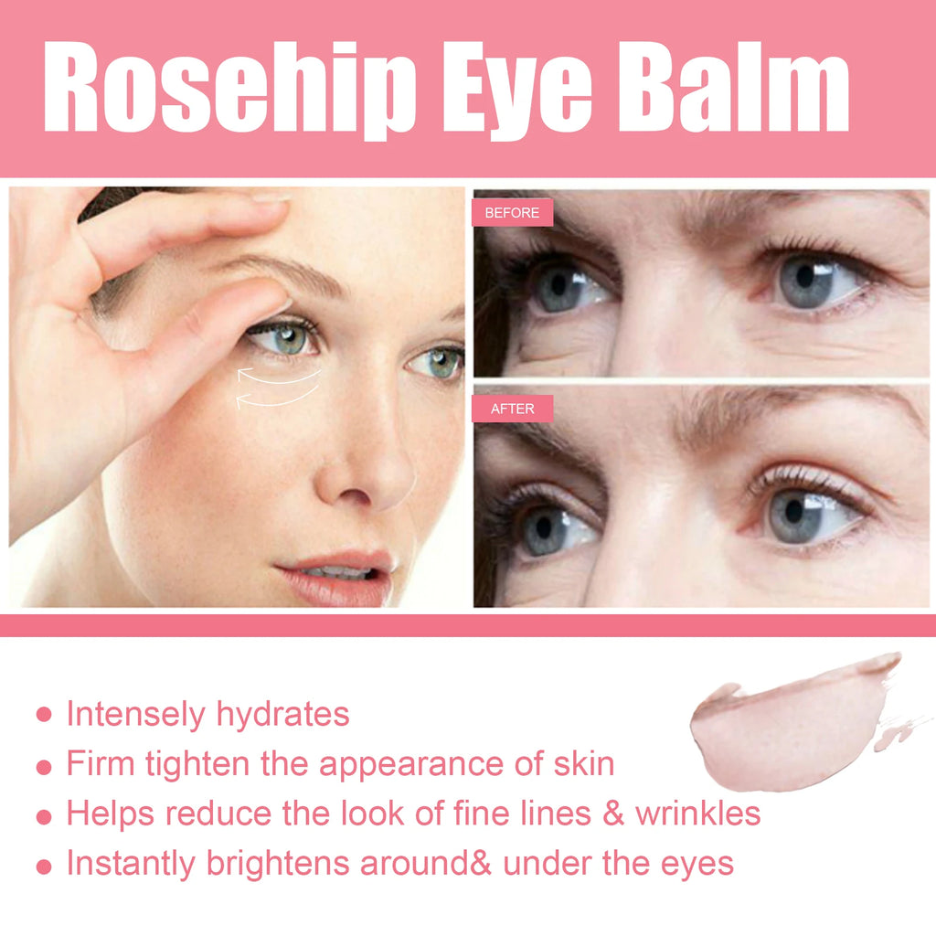 Women Extra Renewing Rosehip Eye Balm Face Lifting Moisturizing Balm Stick Fine Lines Removal Hyaluronic around the Eye Care15ml